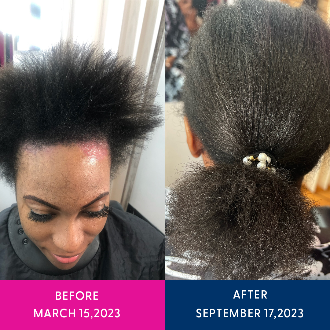 Amazing Hair Growth Elixir